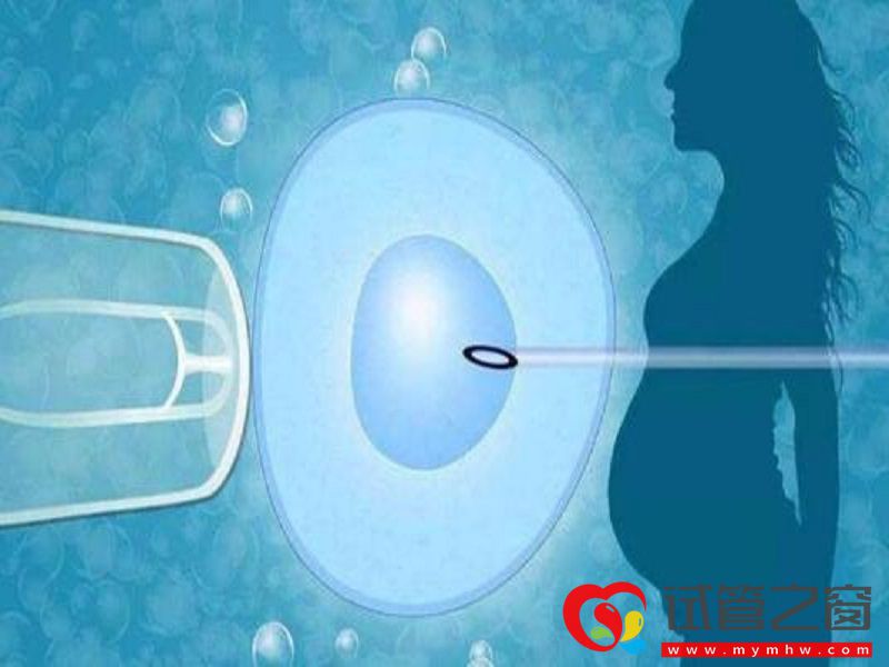 試管一代到四代的特點,局外人也能看懂